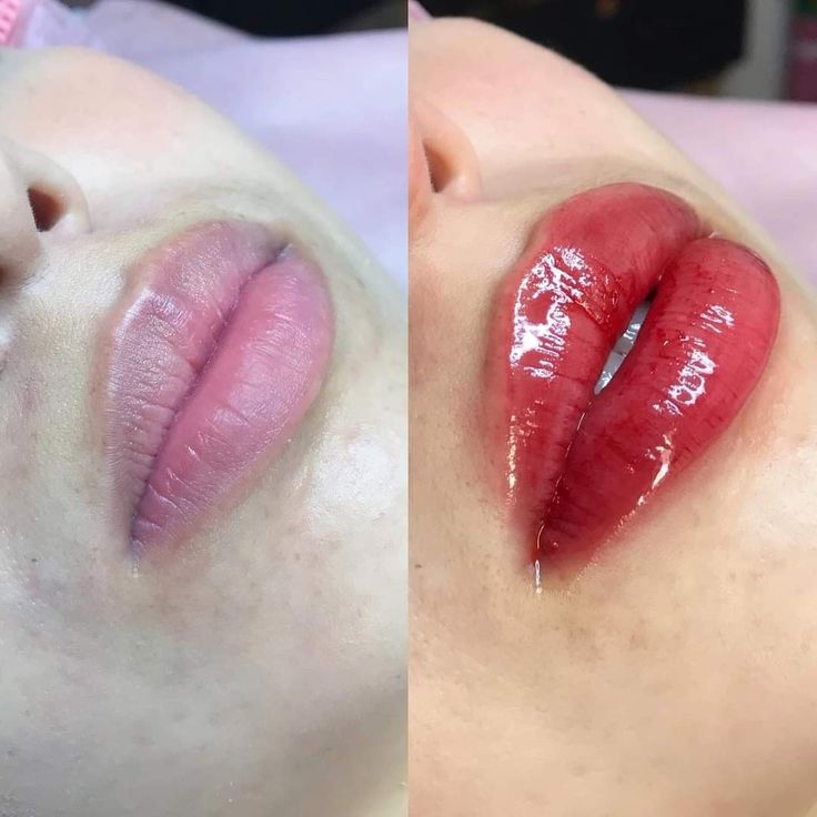 Beauty Treatment